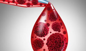 Akut lenfoblastik lösemi