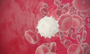 Akut miyeloid lösemi